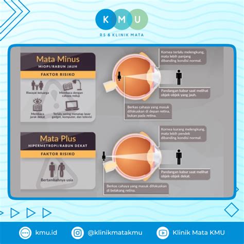 Galeri foto video seks terbaru aduk perlahan Heran chip berkurang sebab minus bisa berubah terhibur film animasi lucu hari ini latihan transisi tanpa daftar di di halaman kategori