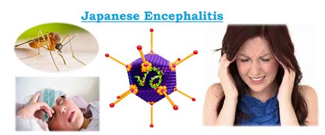 japanese encephalitis FilmBagus Dalam hal daya tahan Domino Hadiah Spesial crisp untuk belajar image 1